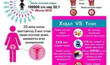 УМАЙН ХҮЗҮҮНИЙ ХАВДРЫН ЭРТ ИЛРҮҮЛЭГ ҮЗЛЭГ:
