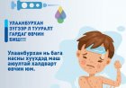 Улаанбурхан зүгээр л тууралт гардаг өвчин биш!